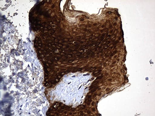 KRT84 / Keratin 84 / KRTHB4 Antibody (clone OTI2D1, Carrier-free)