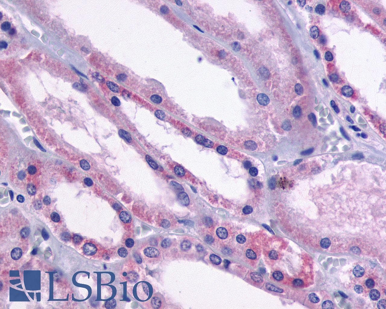 PathPlus™ Polyclonal Rabbit anti-Human DRD1 / Dopamine Receptor D1 Antibody (Cytoplasmic Domain, IHC)