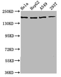 Polyclonal Rabbit anti-Human NEDL2 / HECW2 Antibody (IHC, IF, WB)