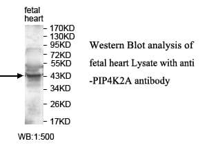 PIP4K2A / PIPK Antibody (aa21-278)