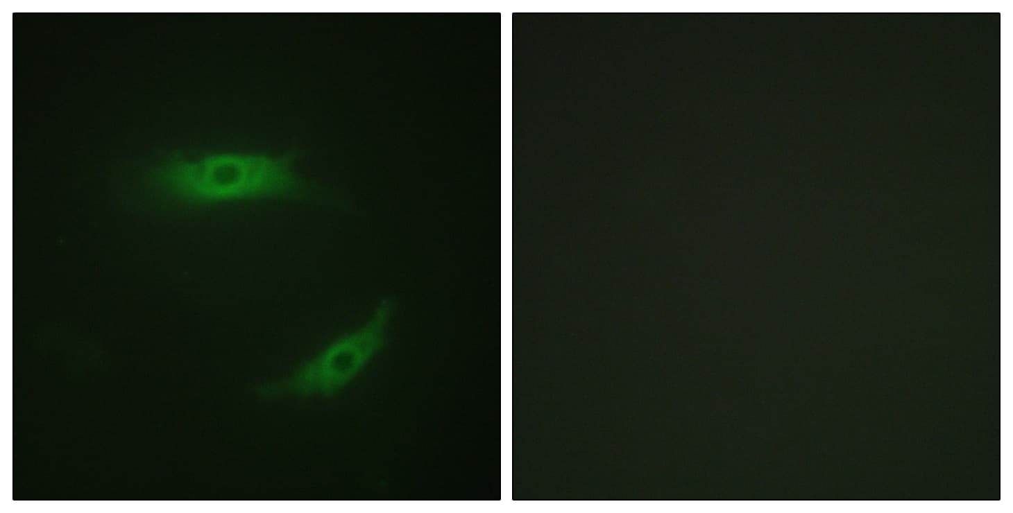 CD4 Antibody (phospho-Ser433)