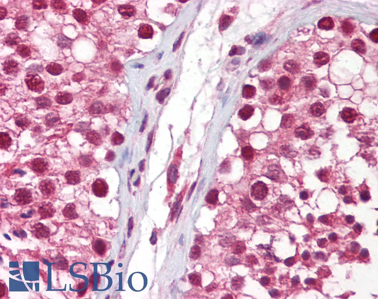 IHC-plus™ NANOS1 / NOS1 Antibody (aa50-100)