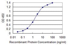 ABCB1 / MDR1 / P Glycoprotein Antibody (clone 1F11)