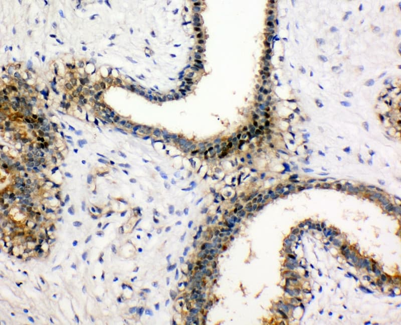 NME1 / NM23 Antibody (aa137-152)