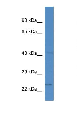 SLC10A2 / ASBT Antibody (aa50-99)