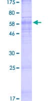 Human CTNS / Cystinosin Protein (Recombinant GST)