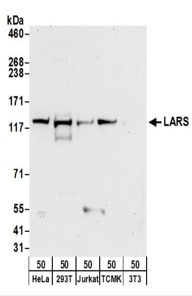 Polyclonal Rabbit anti-Human LARS / Leucyl-TRNA Synthetase Antibody (aa250-300, IHC, WB)