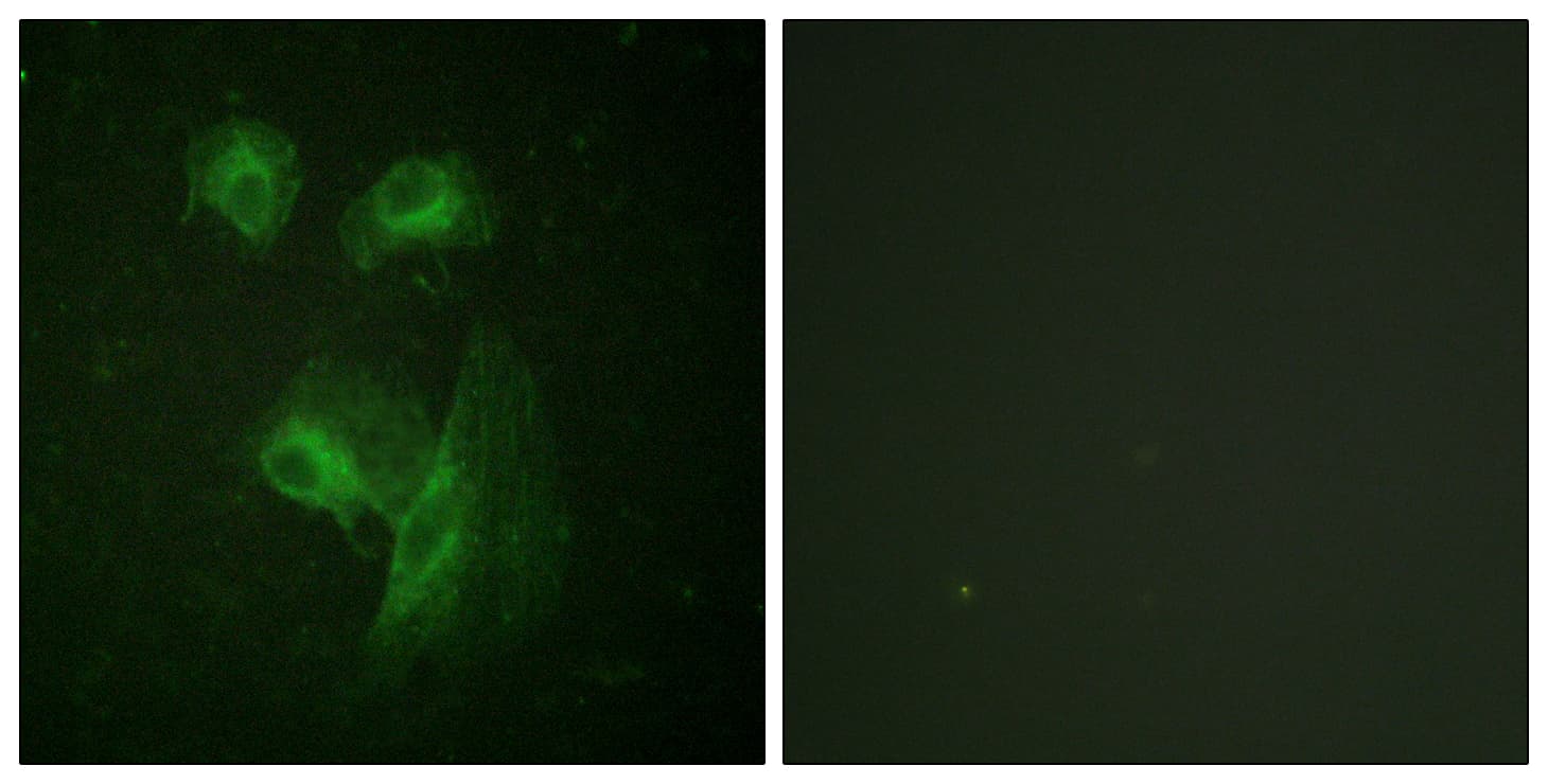 RPS6KB1 / P70S6K / S6K Antibody (aa195-244)