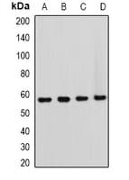 Polyclonal Rabbit anti-Human FBXW11 Antibody (IHC, IF, WB)