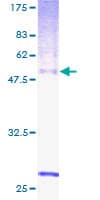 Human RGR Protein (Recombinant GST)