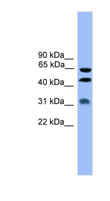 Polyclonal Rabbit anti-Human SERPINA4 / Kallistatin Antibody (aa271-320, WB)