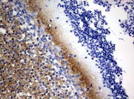 VILIP / VSNL1 Antibody (aa2-191, clone OTI1G10, Carrier-free)