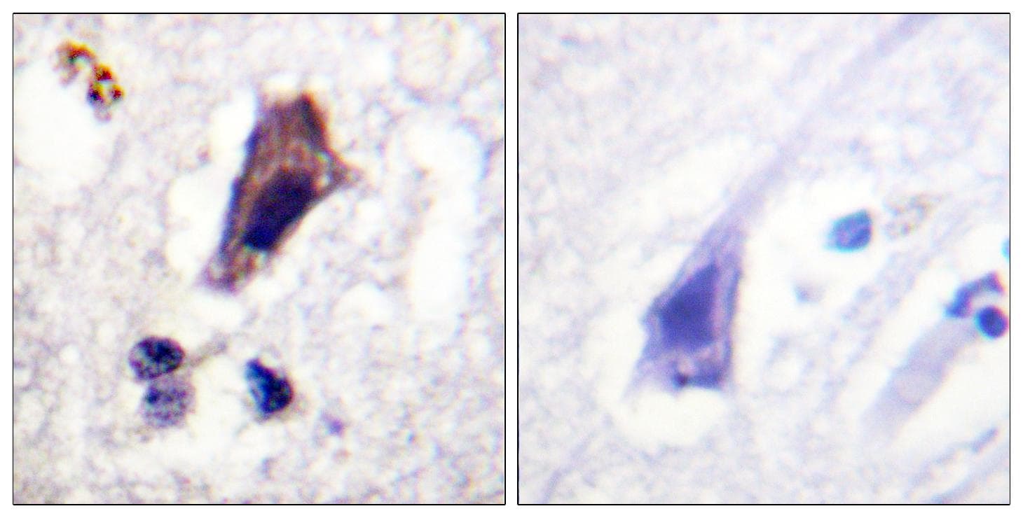 PIKFYVE / PIP5K Antibody (phospho-Ser307)