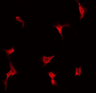 Polyclonal Rabbit anti-Human LDOC1L Antibody (IF, WB)