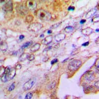 C14orf2 Antibody (Internal)