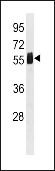 Polyclonal Rabbit anti-Human CPVL Antibody (aa448-476, WB)