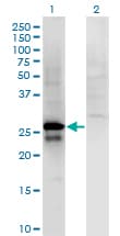Monoclonal Mouse anti-Human SP2 Antibody (clone 5D3, WB)