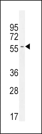 INHBA / Inhibin Beta A Antibody (aa85-112)