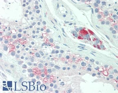 17-Beta Estradiol Antibody