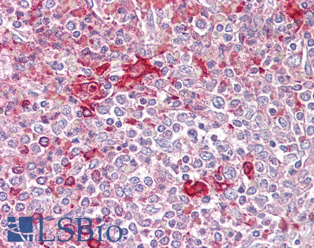 IHC-plus™ TLR5 Antibody (aa300-350)