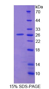 Human DDC / DOPA Decarboxylase Protein (Recombinant His)