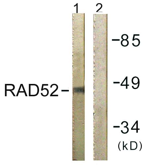 Polyclonal Rabbit anti-Human RAD52 Antibody (p104, IHC, IF, WB)
