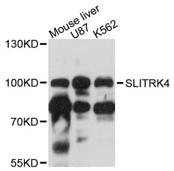 Polyclonal Rabbit anti-Human SLITRK4 Antibody (WB)