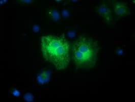 FSHB / FSH Beta Antibody (clone OTI4B9)