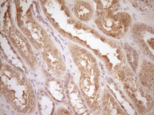 Monoclonal Mouse anti-Human CSF1 / MCSF Antibody (clone OTI8E1, aa223-496, IHC, WB)