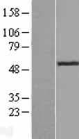TADA2L / ADA2A Protein (Over-Expression Lysate Myc-DDK (Flag))