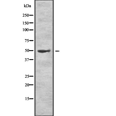 LCAT Antibody