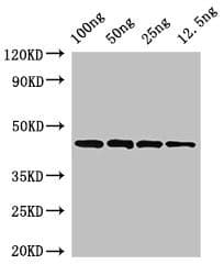 Polyclonal Rabbit anti-Streptococcus pyogenes speB Antibody (WB)