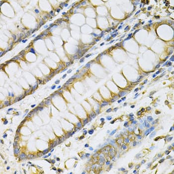 PDGF-BB Antibody