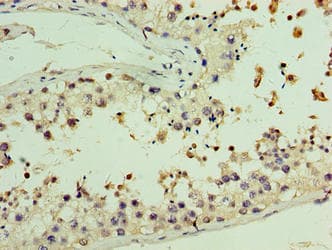 Polyclonal Rabbit anti-Human AASDHPPT / LYS5 Antibody (aa1-309, IHC, WB)