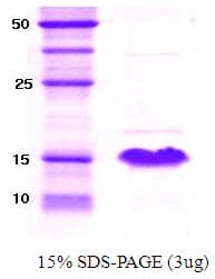 Human SNCA / Alpha-Synuclein Protein (Recombinant)