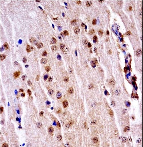 NEK3 Antibody (aa446-474)