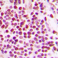 CUL2 / Cullin 2 Antibody (C-Terminus)