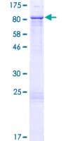 Human ZNF169 Protein (Recombinant GST)