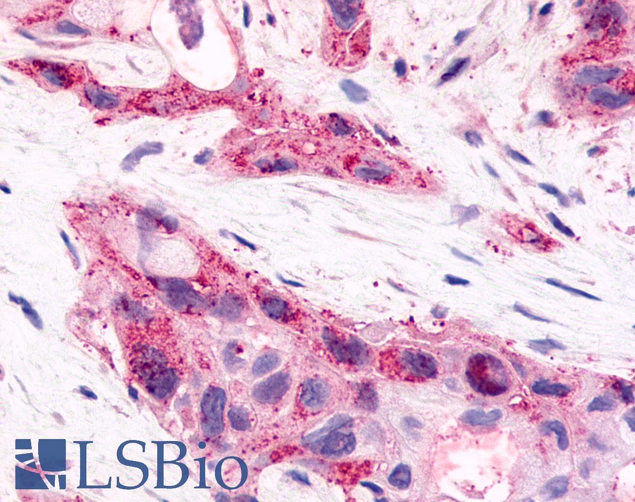 PathPlus™ HNF4G / HNF4 Gamma Antibody (Internal)