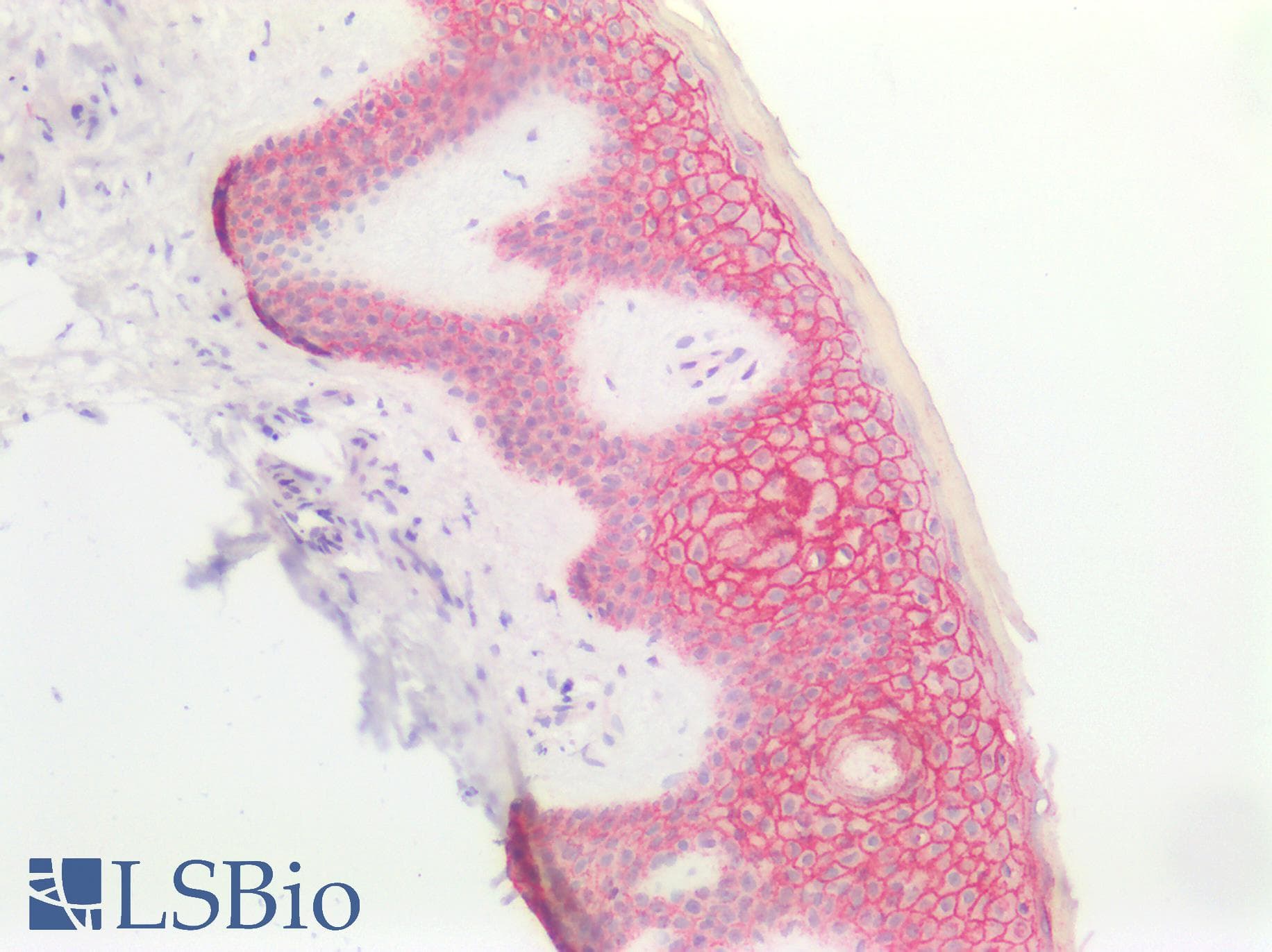 IHC-plus™ Polyclonal Rabbit anti-Human SDC1 / Syndecan 1 / CD138 Antibody (aa23-254, IHC, IF)