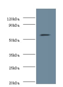 NOP58 / NOP5 Antibody (Biotin)