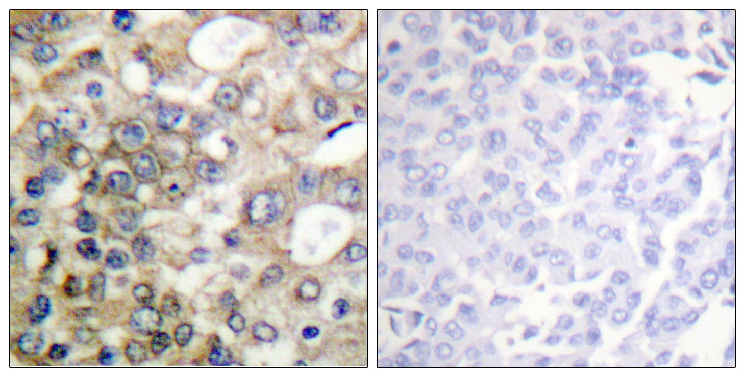 EMA / MUC1 Antibody (phospho-Tyr1229)