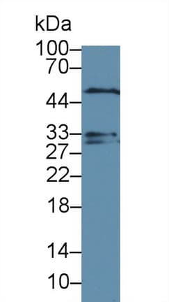 DTNBP1 / Dysbindin Antibody