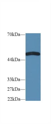 TNFRSF19L / RELT Antibody (aa222-363)
