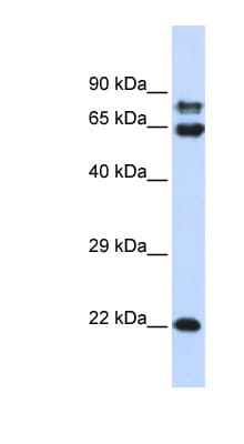 PPP2R1A Antibody (aa107-156)
