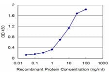 UMPS / OPRT Antibody (clone 2B10)