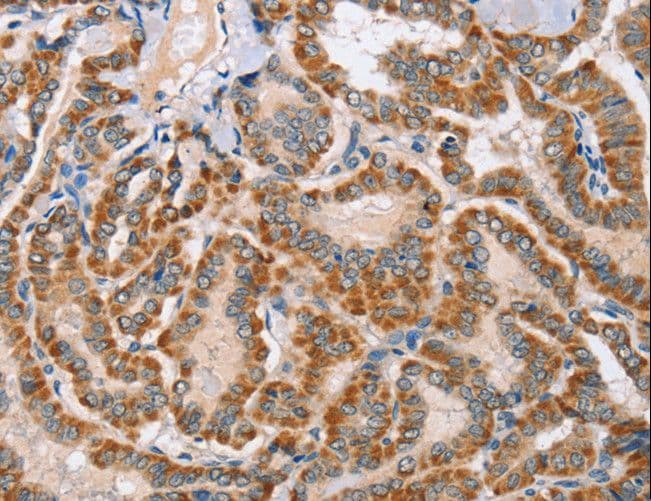 Polyclonal Rabbit anti-Human MSMB / MSP Antibody (IHC, WB)