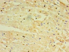 TRIM11 Antibody (aa267-468)