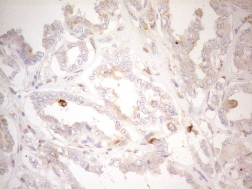 Monoclonal Mouse anti-Human GRN / Granulin Antibody (clone OTI3H6, aa327-593, IHC, WB)