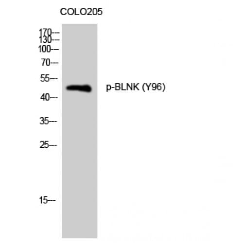 BLNK Antibody (40-120 aa)